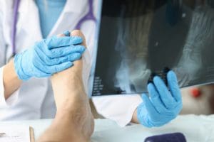 doctor looking at injured foot during doctor's appointment