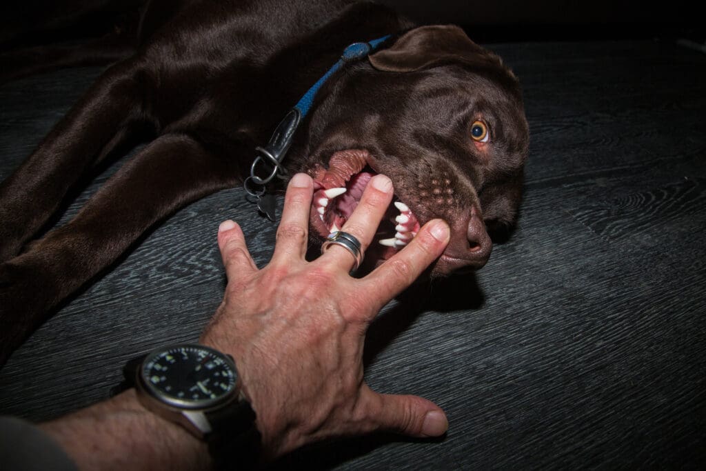 Chevy Chase Dog Bite