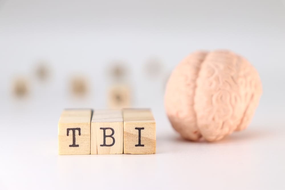 Shirlington TBI attorney