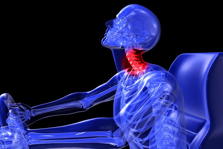 Kensington Spinal Injury Lawyer