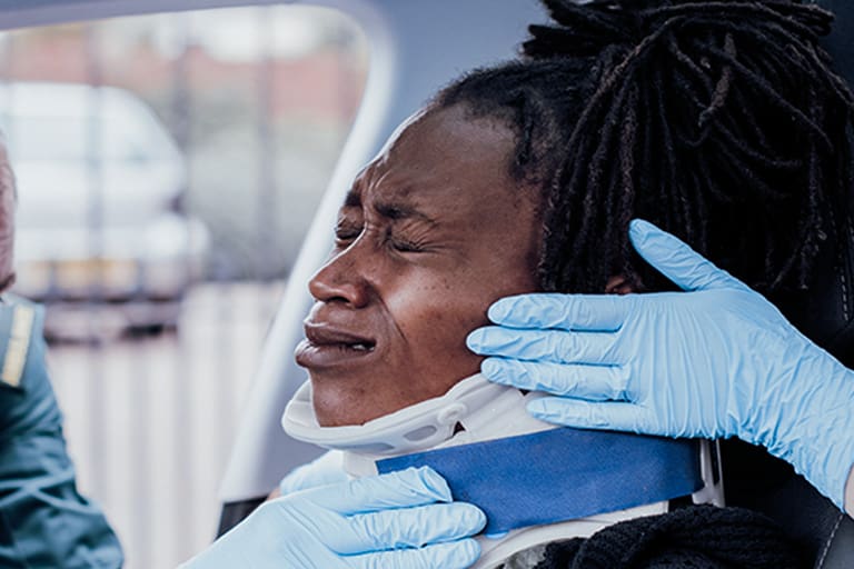 Airbag Burn Injuries