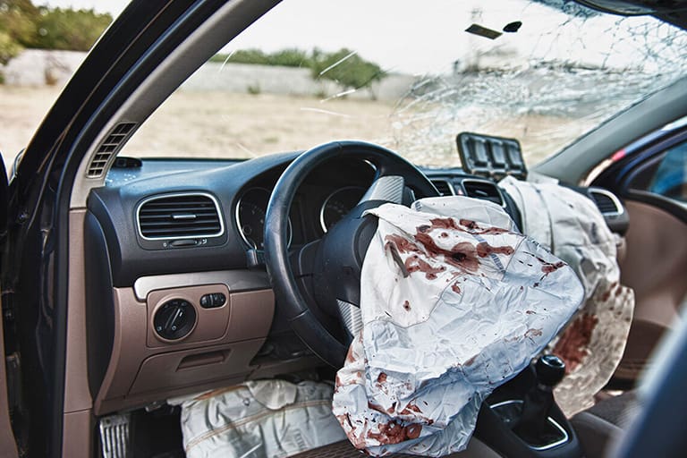 Airbag Burn Injuries