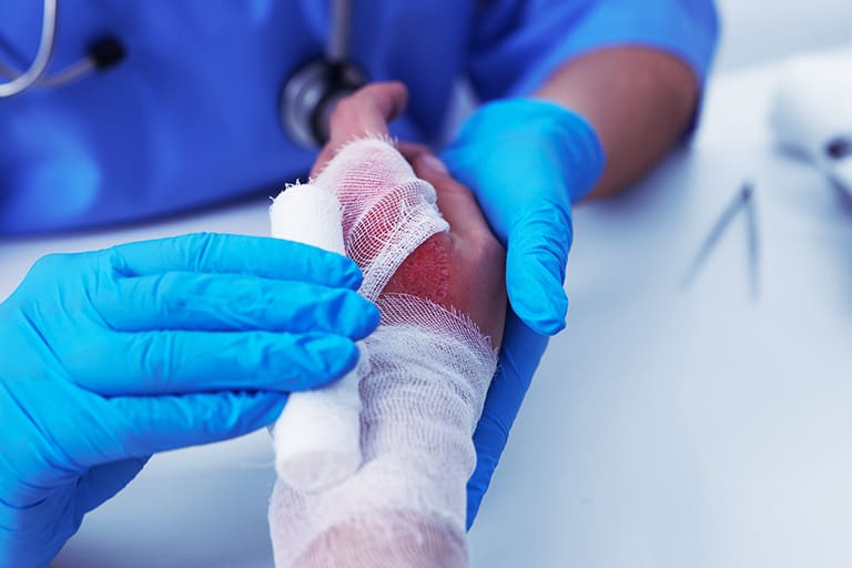 Workers’ Comp Burn Injuries