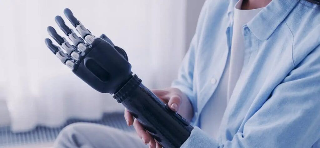 A Brief Guide to Modern Prosthetics - Malloy Law